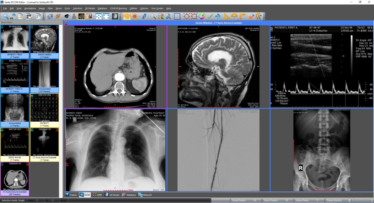 Sante DICOM Editor v10.0.0 – DICOM医学影像编辑器